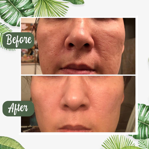 Diystar™ Green Tea Deep Cleanse Mask Stick - TARHUS