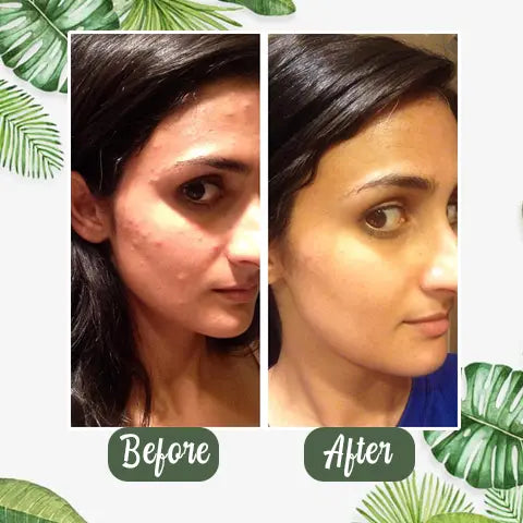 Diystar™ Green Tea Deep Cleanse Mask Stick - TARHUS