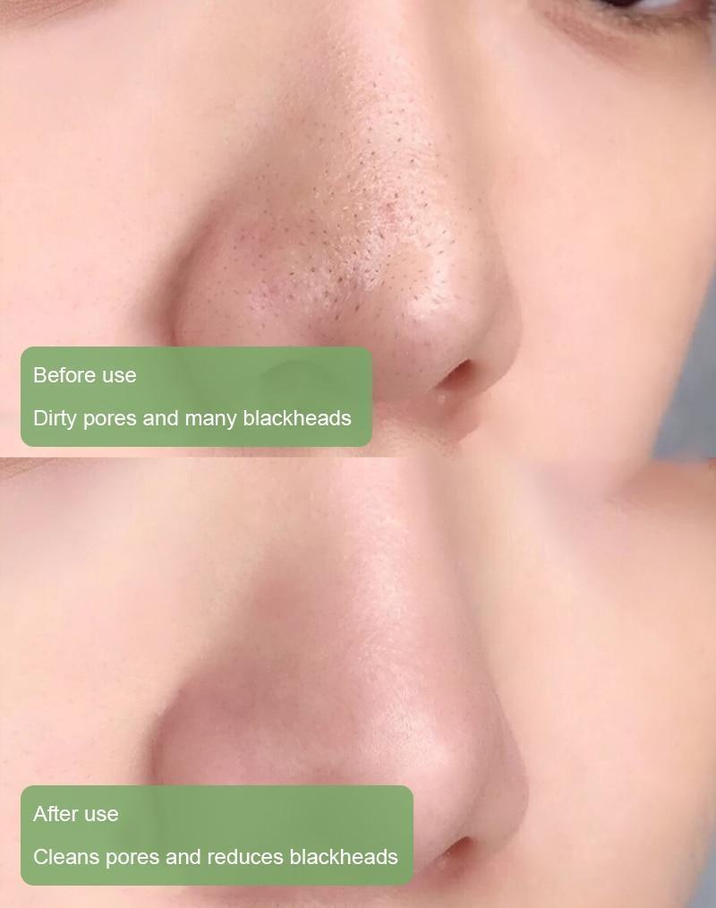 Diystar™ Green Tea Deep Cleanse Mask Stick - TARHUS