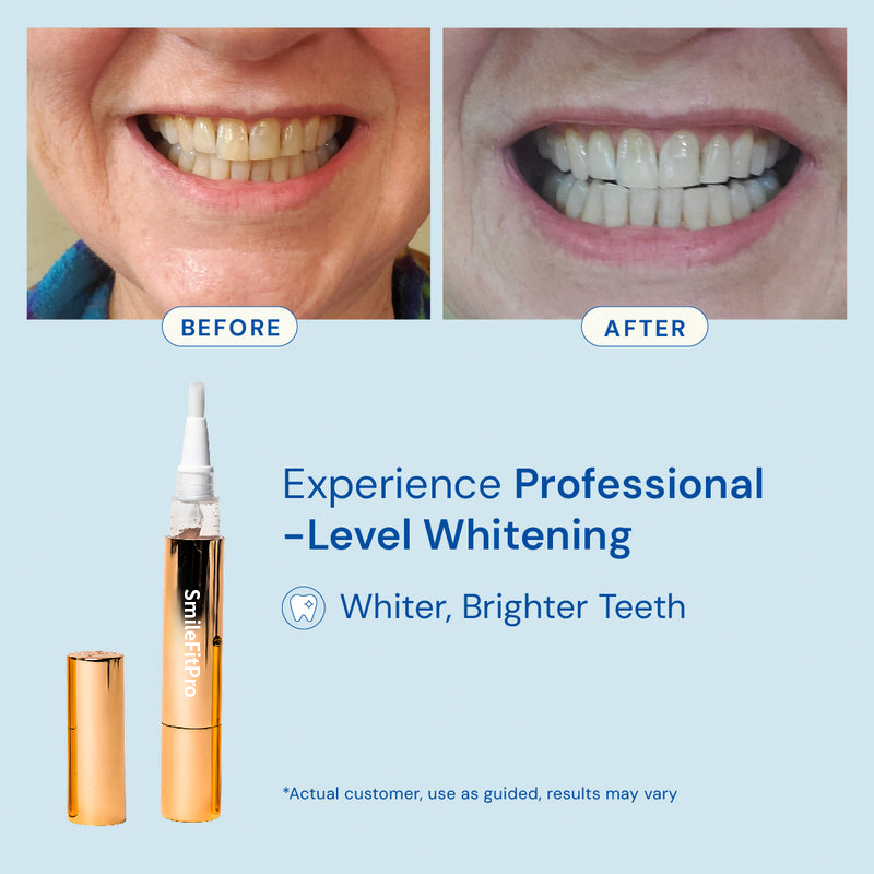 Extra-Strength Teeth Whitening Serum Pen + Dual-Peroxide Formula & Xylitol TARHUS