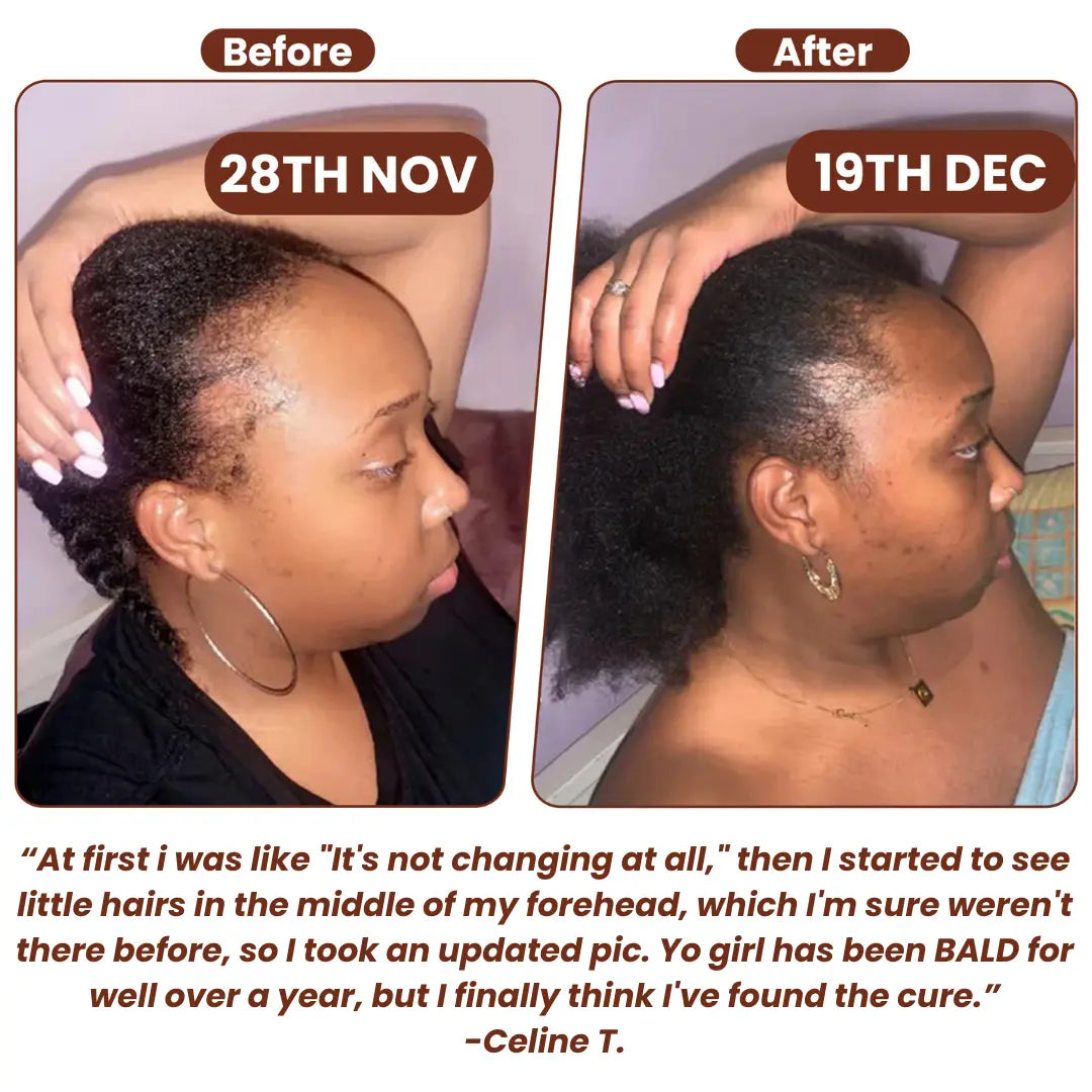 Grows Pure Batana Oil - TARHUS