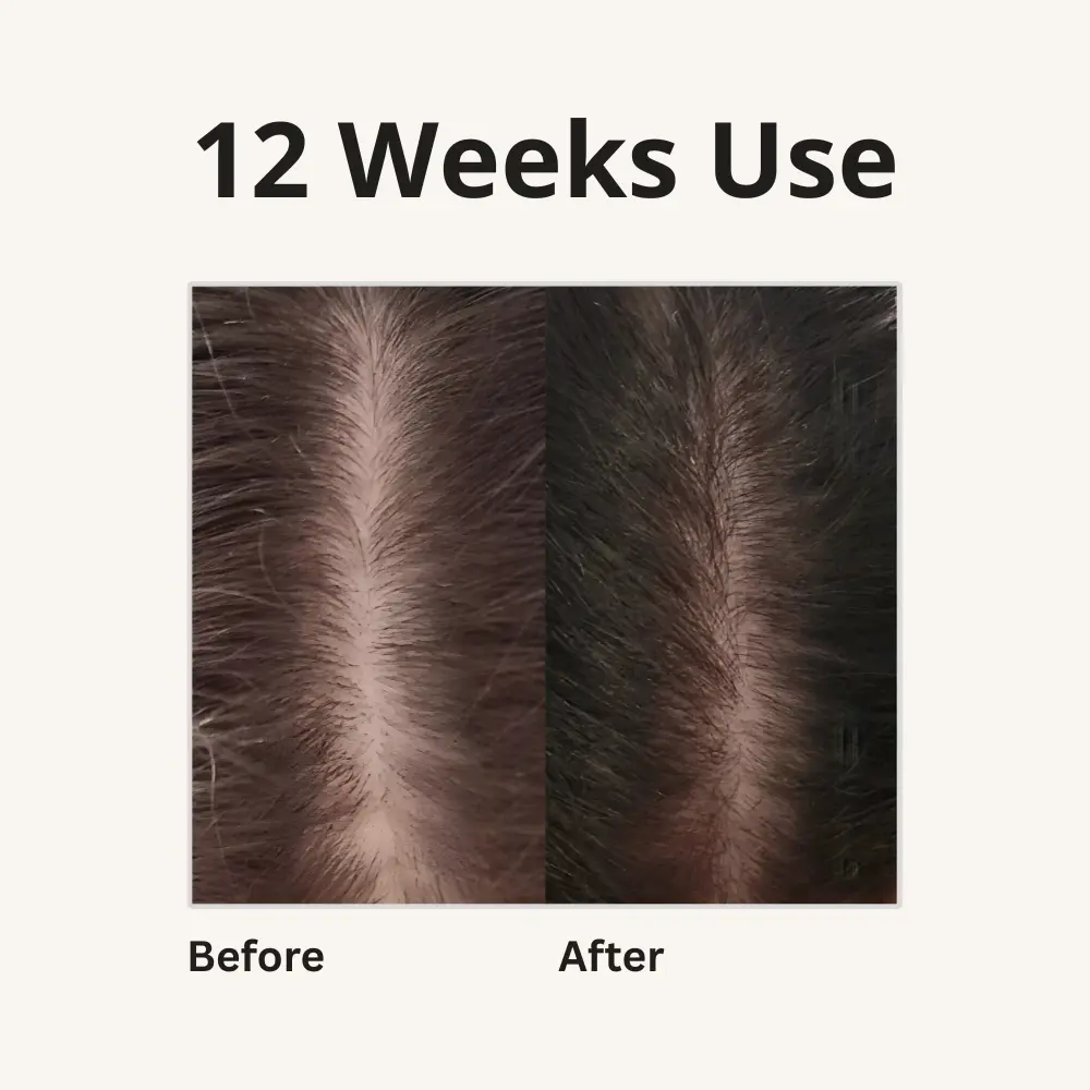 2x 4-in-1 Batana Hair Oil - TARHUS