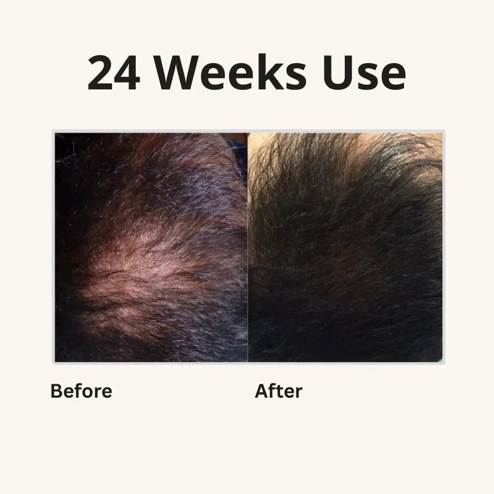 2x 4-in-1 Batana Hair Oil - TARHUS