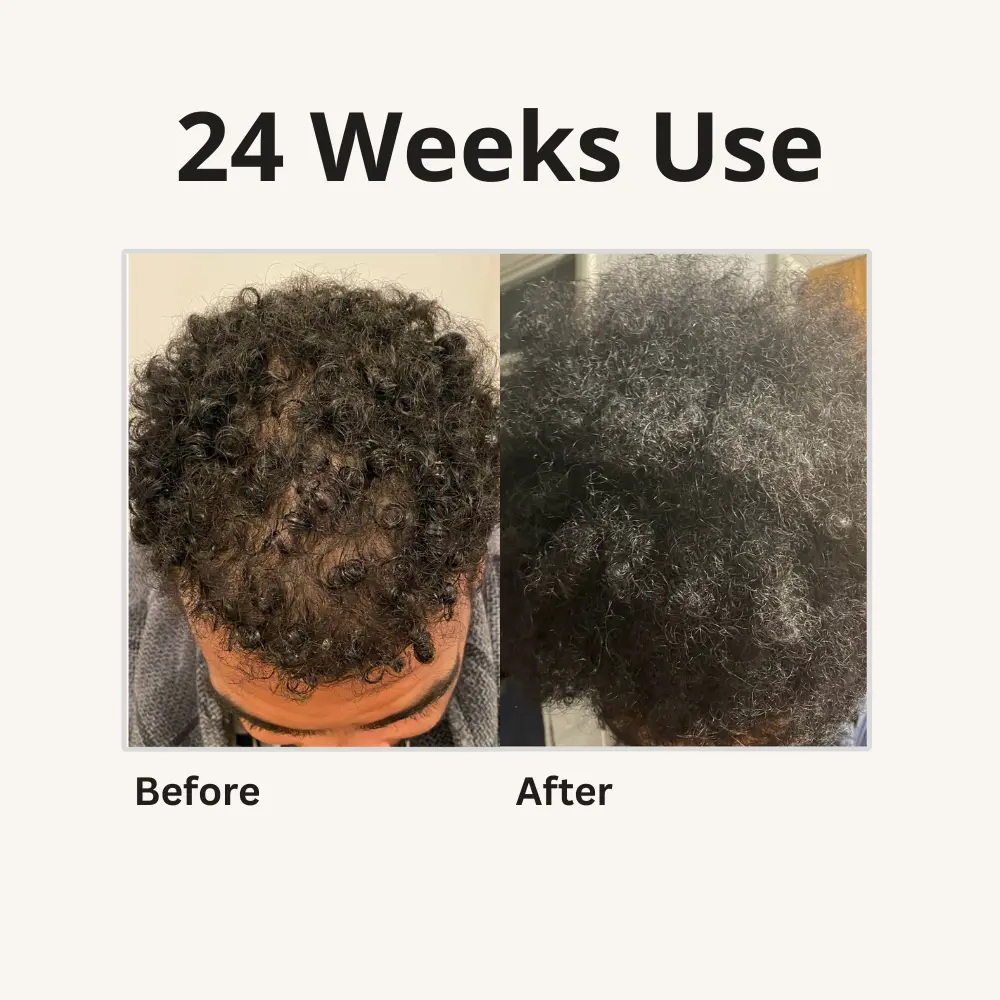 2x 4-in-1 Batana Hair Oil - TARHUS