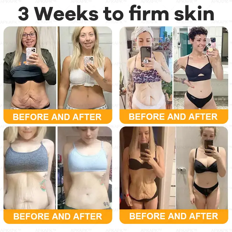 1+1 FREE | Bee Venom Comprehensive Cream - TARHUS