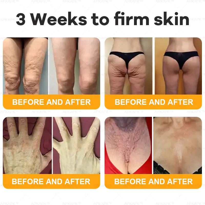 1+1 FREE | Bee Venom Comprehensive Cream - TARHUS