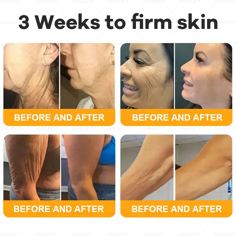 1+1 FREE | Bee Venom Comprehensive Cream - TARHUS