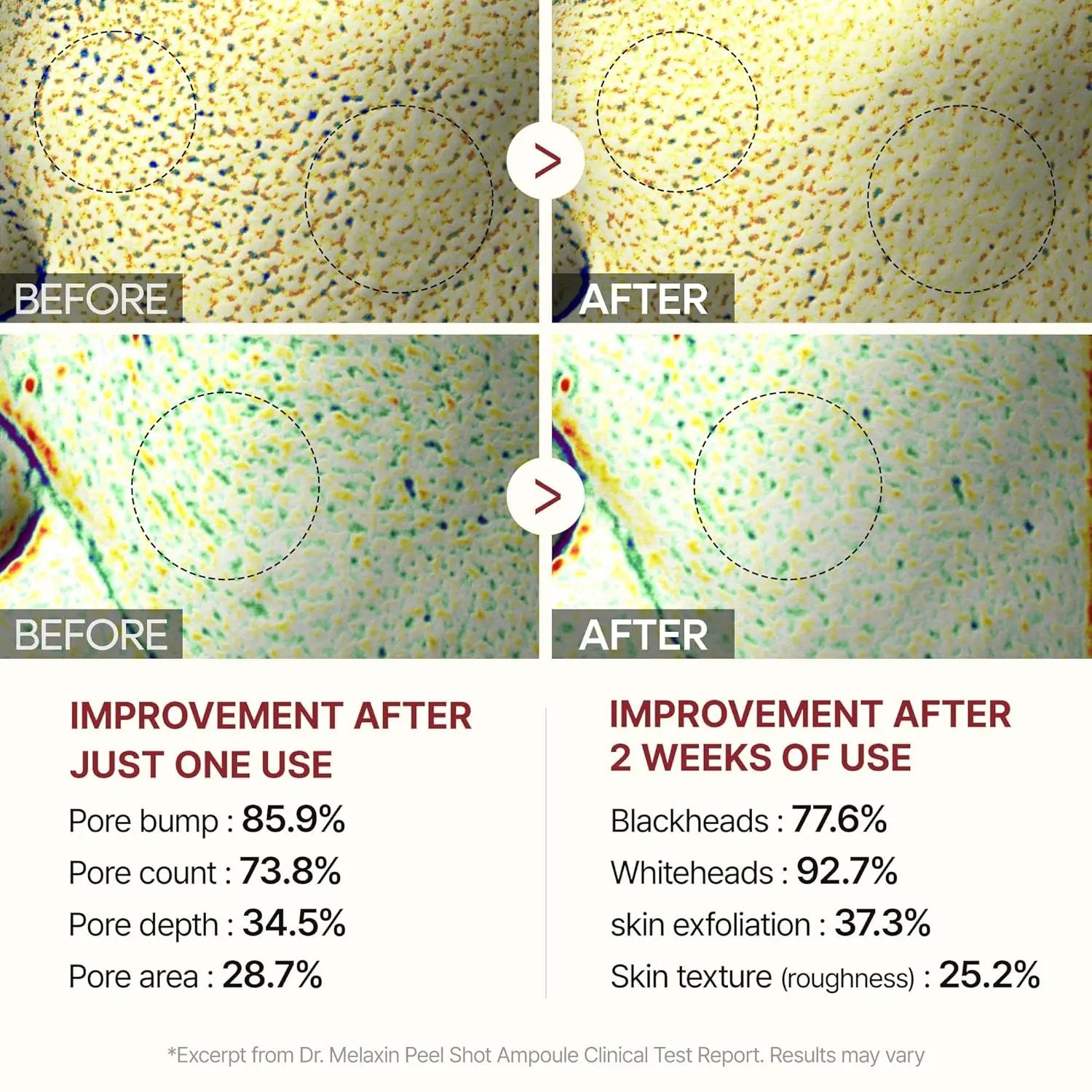 Radiant Glow | Rice Peeling Ampoule – Brightening Exfoliation & Hydration TARHUS