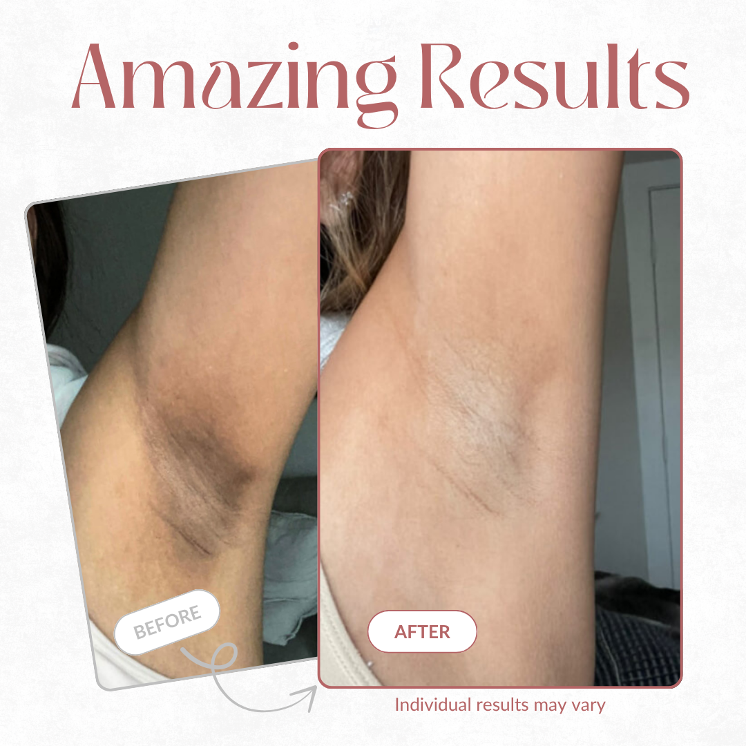 CocoBeauty Peel Shot | Kojic + Turmeric Exfoliating Spray – Radiant Skin, Simplified TARHUS