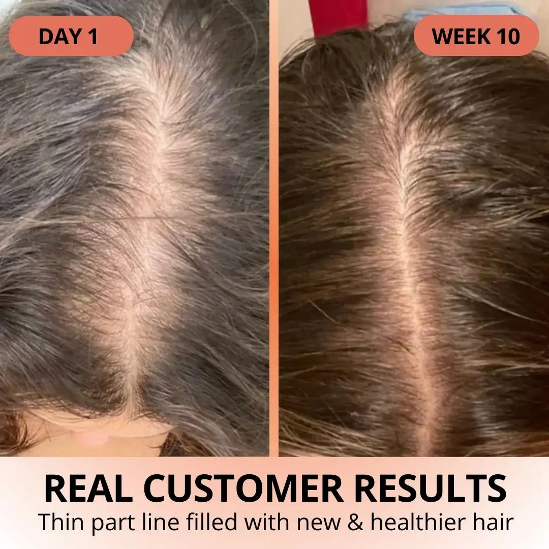 Pumpkin Seed Oil Softgels - TARHUS