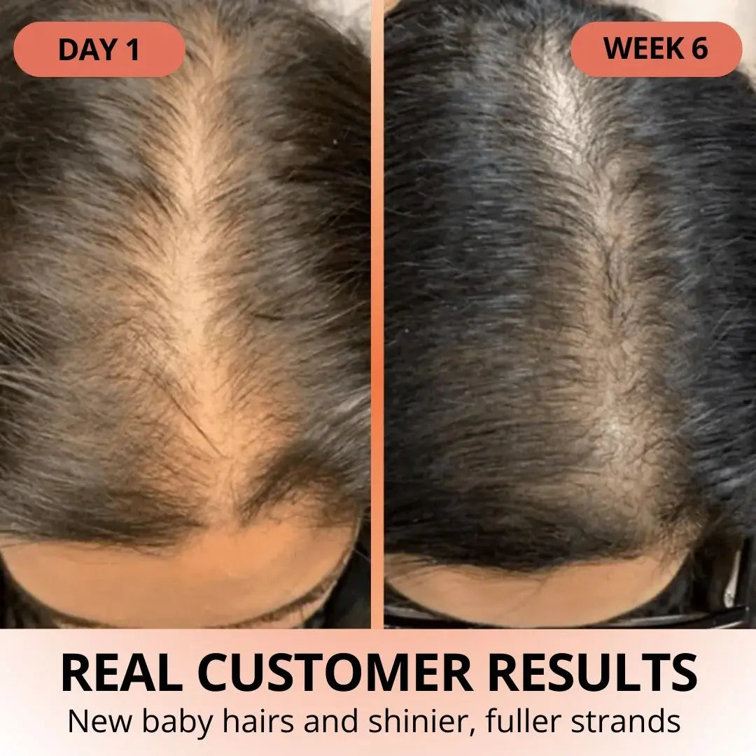 Pumpkin Seed Oil Softgels - TARHUS