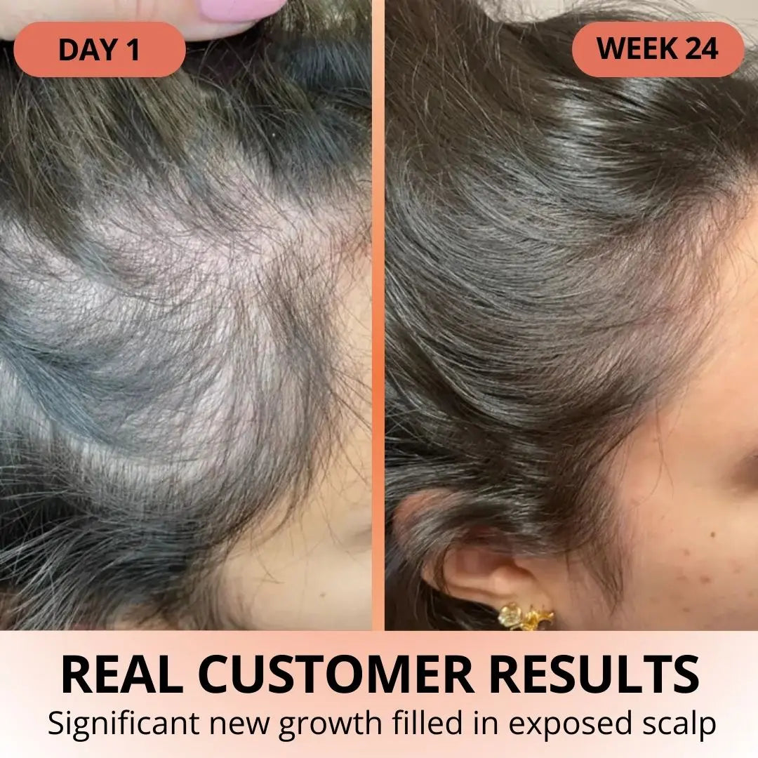 Pumpkin Seed Oil Softgels - TARHUS