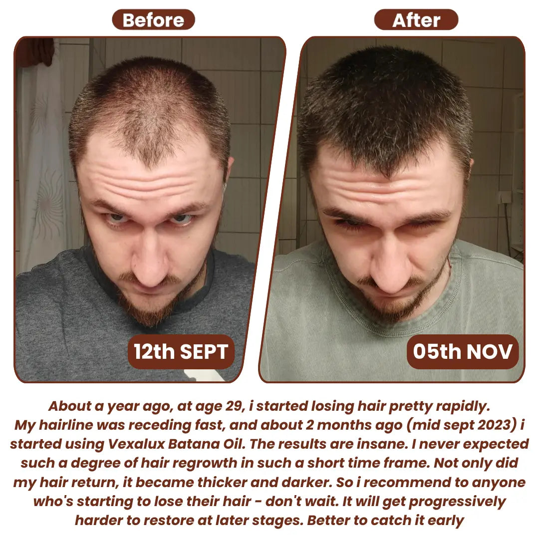 Grows Pure Batana Oil - TARHUS