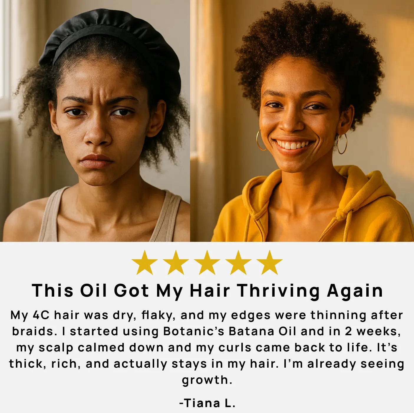 Batana Hair Growth Oil – 100% Natural Scalp Treatment for Thicker, Healthier Hair - TARHUS