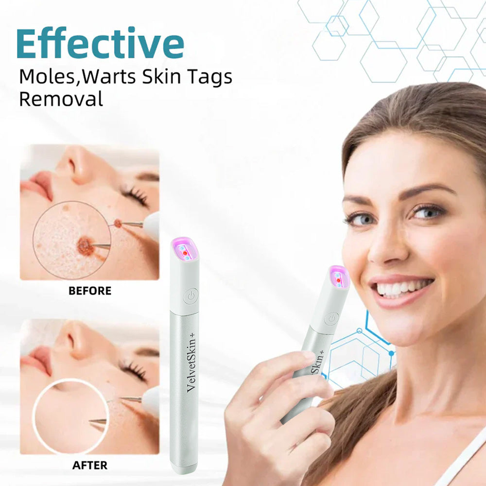 VelvetSkin Laser Eraser Pen | Remove Moles, Warts & Dark Spots Safely TARHUS ENN-VHH