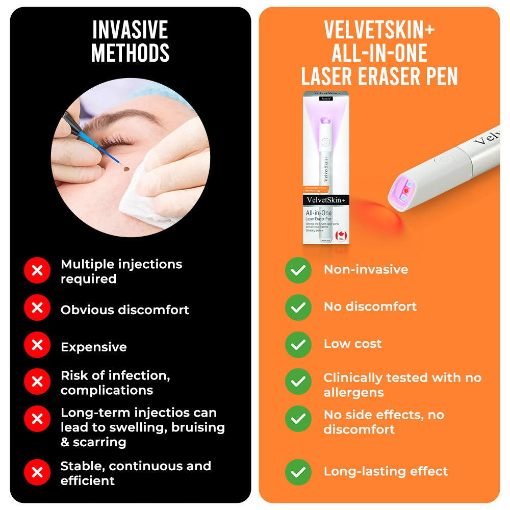 VelvetSkin Laser Eraser Pen | Remove Moles, Warts & Dark Spots Safely TARHUS ENN-VHH