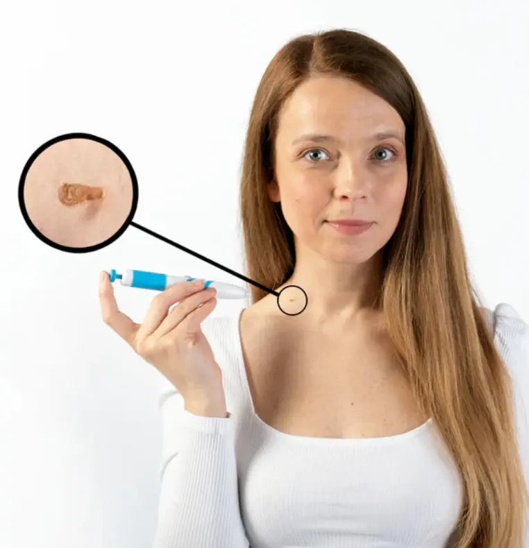 Tag Eraser Pro Kit - TARHUS