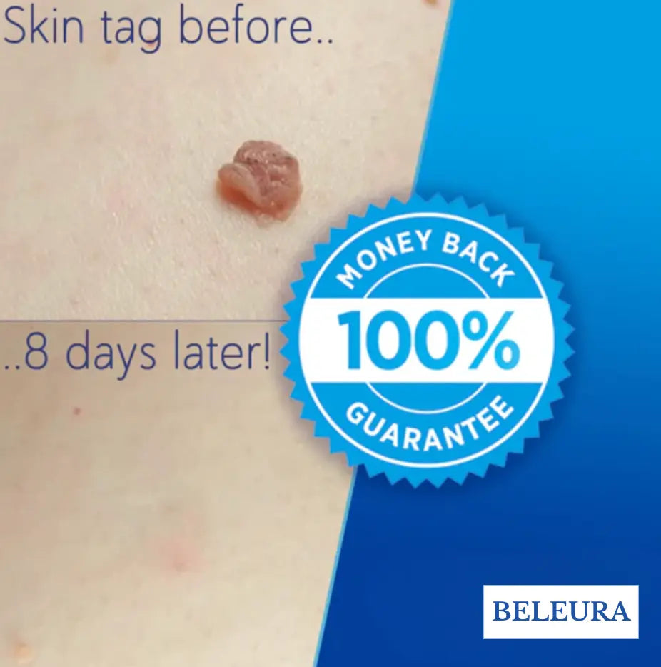 Tag Eraser Pro Kit - TARHUS