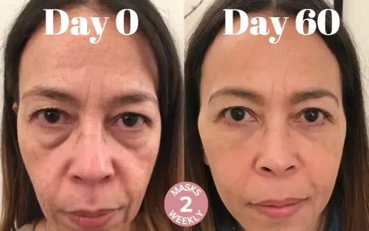 Microcrystalline Laugh Line Lifting Mask - TARHUS