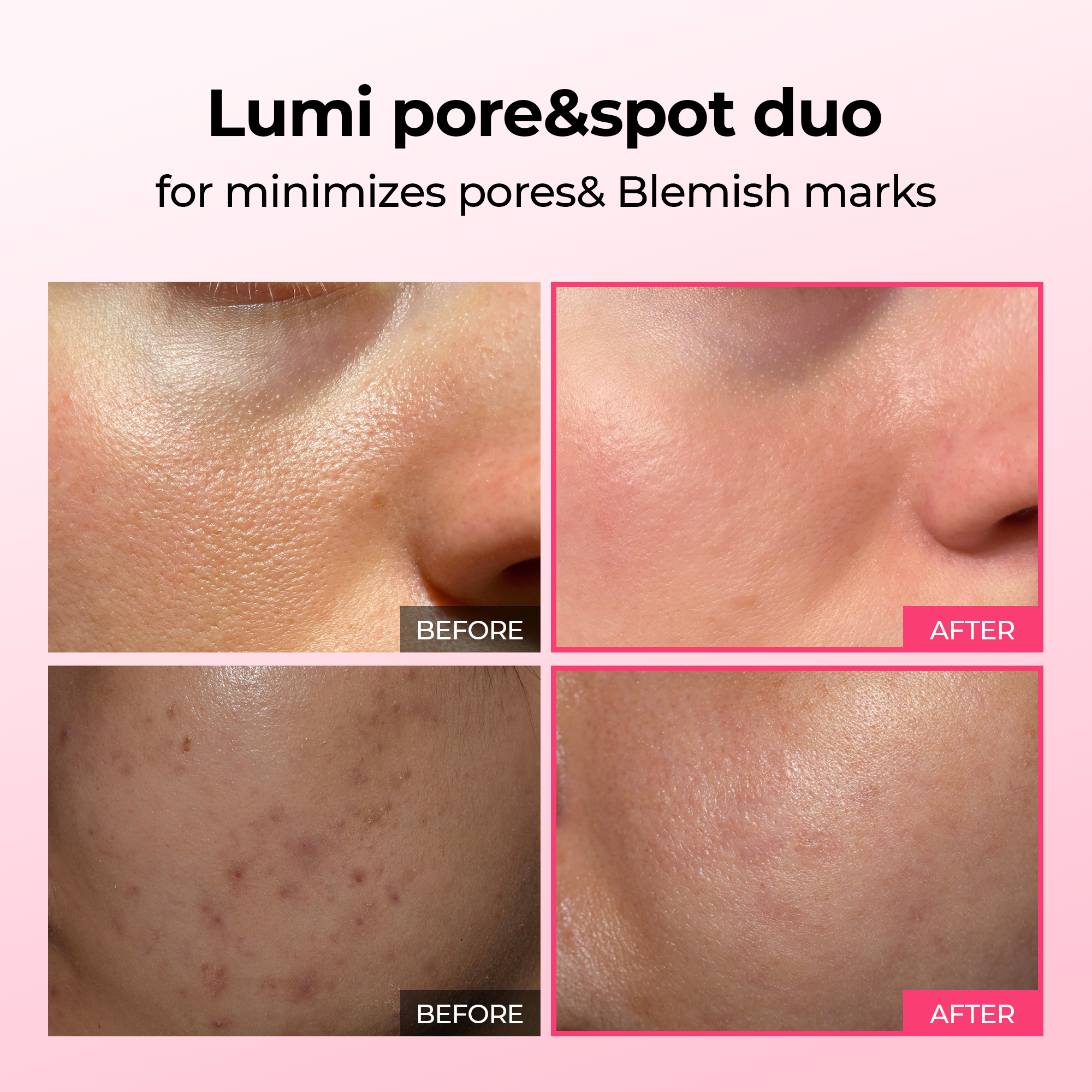 TARHUS | Lumi Pore & Spot Care Duo TARHUS