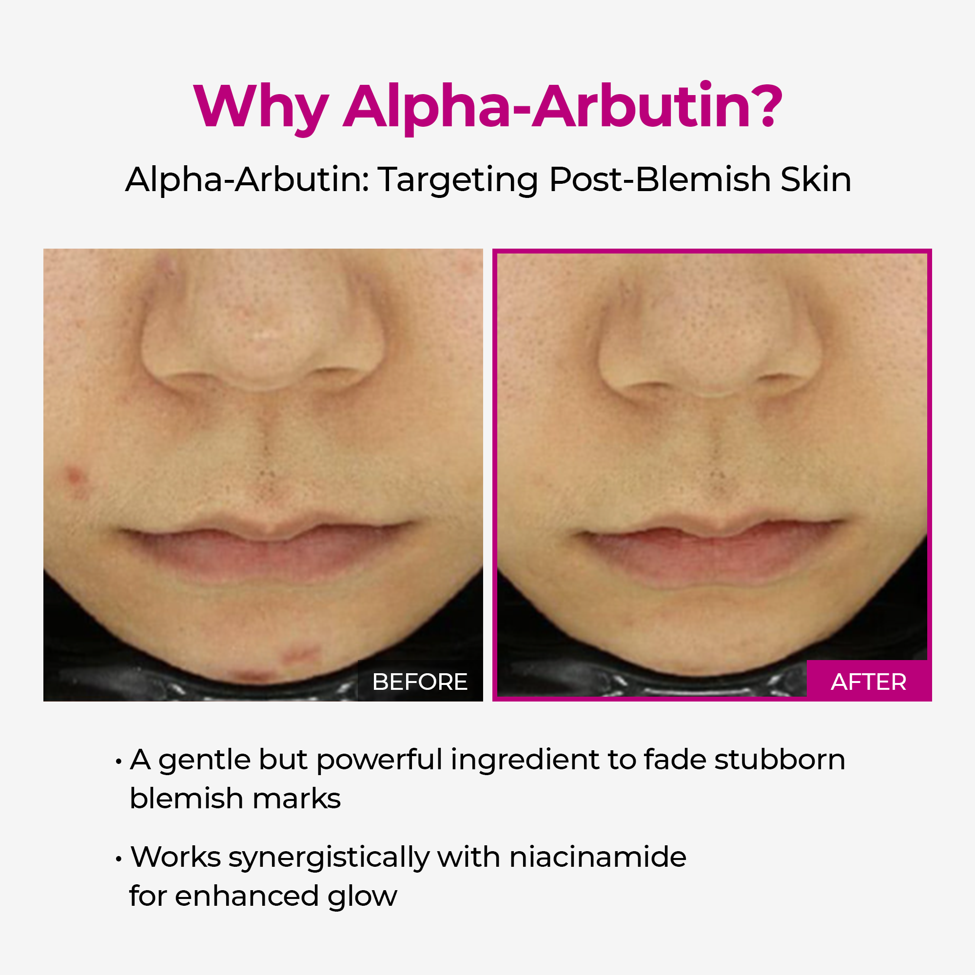 TARHUS | Lumi Pore & Spot Care Duo TARHUS