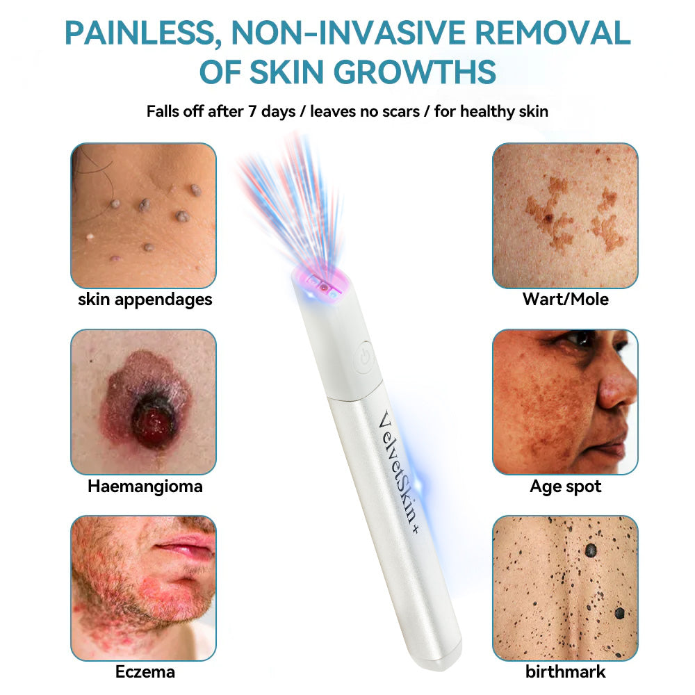VelvetSkin Laser Eraser Pen | Remove Moles, Warts & Dark Spots Safely TARHUS  ENN-VHH