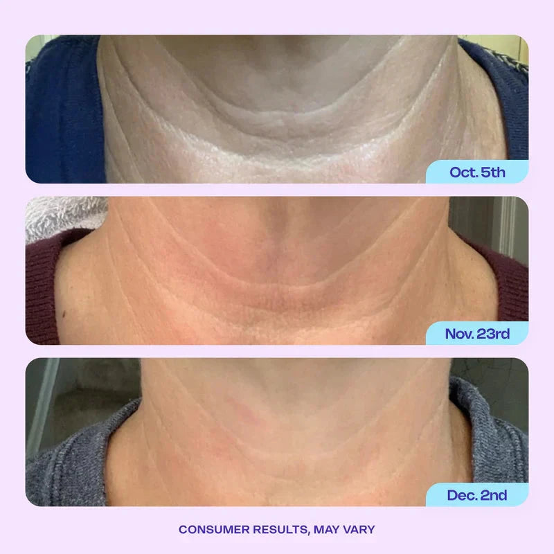 Neck Cream | Tighten & Lift – Visibly Smooth Tech Neck & Sagging Skin TARHUS